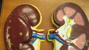 fot. Greenflames09, CC