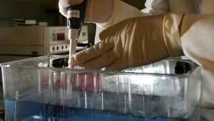 Komórki wątroby pomogą w leczeniu cukrzycy?