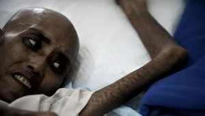 Chory na AIDS w jednym z hospicjów w Tajlandii