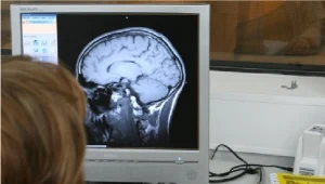 Za mało snu, mniejszy mózg