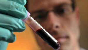 To przełom w walce z białaczką?