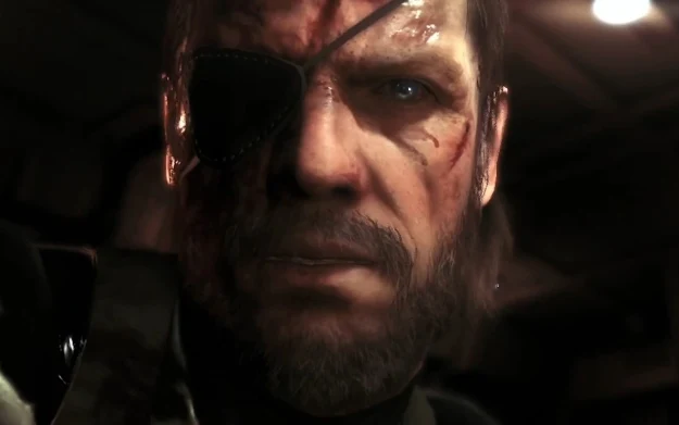 MGS5 MGS5