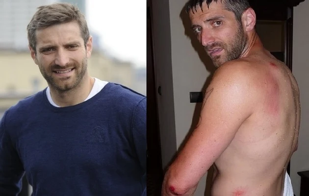 Maciek Dowbor przed i po wypadku