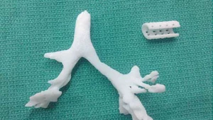 Model dróg oddechowych dziecka i rurka wydrukowana na drukarce 3D /University of Michigan Health System 