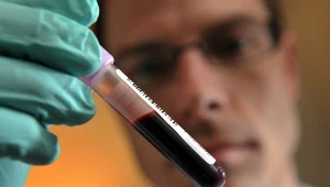 Sportowcy muszą się liczyć z częstymi kontrolami antydopingowymi