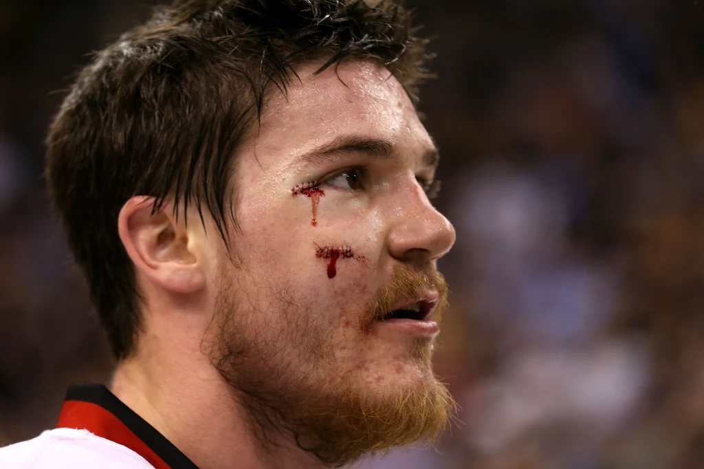 Andrew Shaw pokazuje, jak wiele poświęceń i trudu wymaga zdobycie tytułu Andrew Shaw pokazuje, jak wiele poświęceń i trudu wymaga zdobycie tytułu