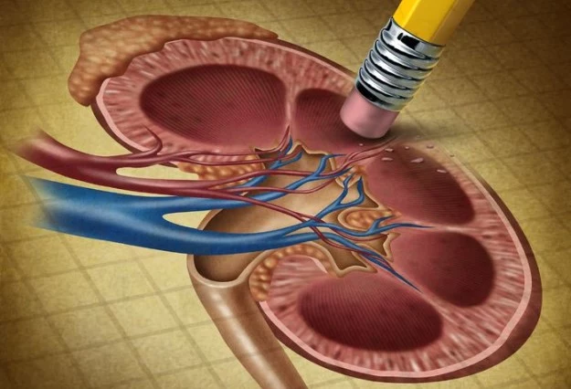 Już niebawem nerki będą bezpieczne podczas operacji?