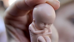 Temat aborcji wciąż wywołuje dyskusje