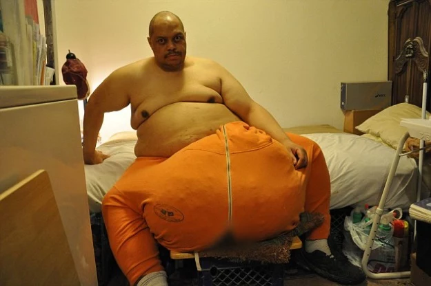 Wesley Warren Jr. miał 70-kilogramową narośl na jądrach. Przez 4 lata nikt nie chciał mu pomóc