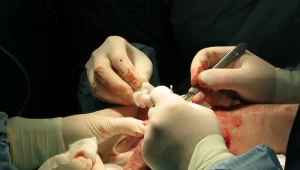 W samochodzie wybuchła bomba-samoróbka