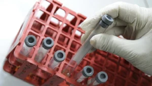 Celem organizowanego od trzech lat konkursu jest zachęcenie do oddawania krwi