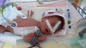 Chłopiec waży jedynie 800 gramów/fot. Barbara Zielińska-Mordarska