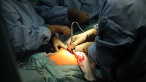 Operacja wszczepienia utranowoczesnej protezy stawu biodrowego/fot. Darek Delmanowicz