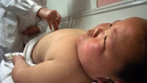 Będą nadal zwalczać otyłość