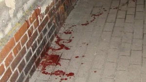 Kolejne pobicie w Grodkowie / fot. Damian Kapinos