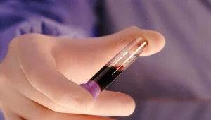 Bezpłatne badania wykrywające choroby nerek