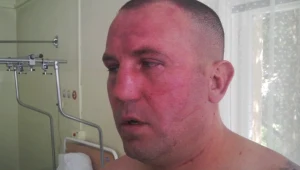 Mężczyzna oskarża policję o pobicie.