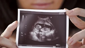 Decyzja o aborcji jest często podejmowana pod wpływem emocji