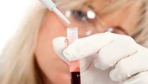 Gdy poziom bilirubiny wzrasta, może to być symptom choroby lub dysfunkcji wątroby, anemii albo zablokowania się dróg żółciowych