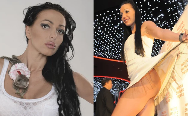 Do końca życia mogę być kaleką - martwi się Agnieszka Orzechowska