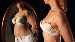 Bulimia ma podłoże psychiczne. Chora osoba panicznie boi się tycia