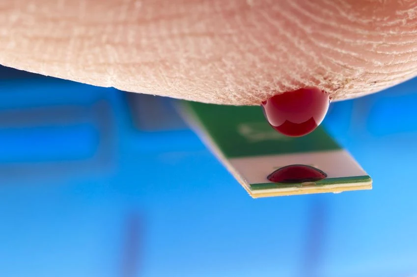 We krwi cukrzyków występuja wysokie stężenie hormonu K1 We krwi cukrzyków występuja wysokie stężenie hormonu K1