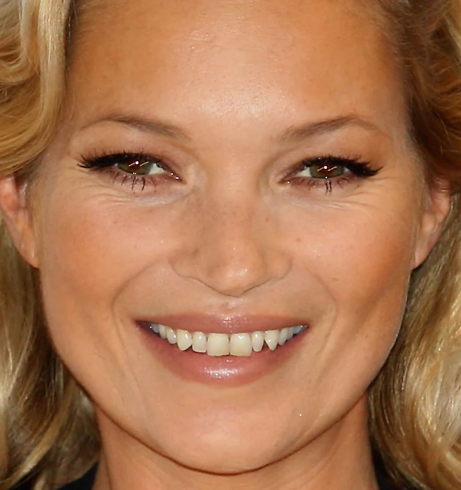 Kate Moss pozbyła się już diastemy, o której mówi stomatolog Kate Moss pozbyła się już diastemy, o której mówi stomatolog