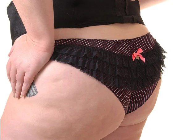 Otyłość w okolicy pośladków i ud może być wskazówką do nadmiaru spożywanych węglowodanów 