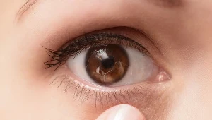 Z jęczmieniem jest jak z katarem - nieleczony trwa siedem dni, a leczony tydzień