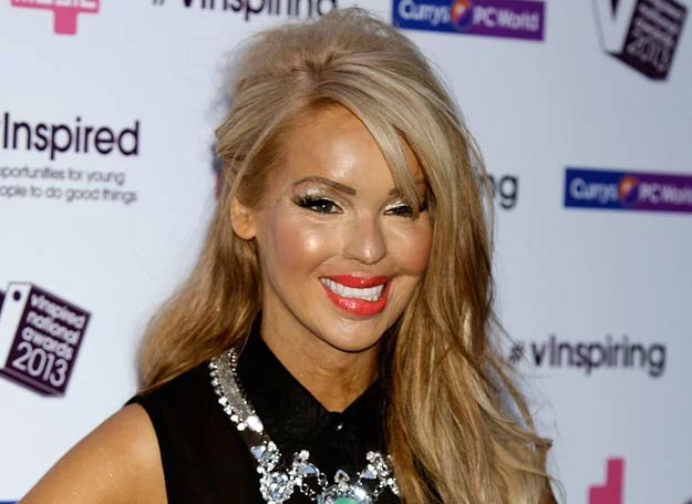 Katie Piper