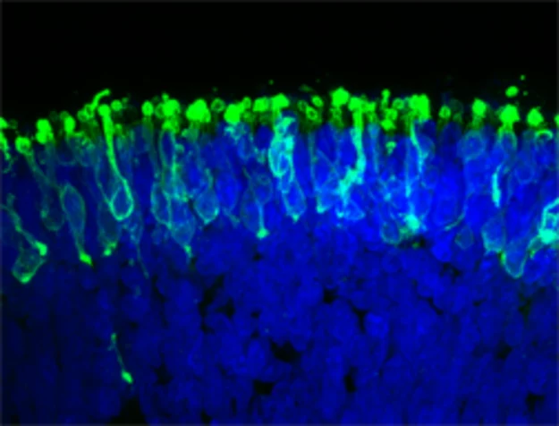 Odtworzona siatkówka z pręcikami (na zielono) Źródło: Johns Hopkins Medicine 