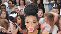 Winnie Harlow 