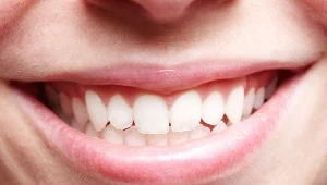 Zdrowe dziąsła to gwarancja mocnych zębów. A te odpowiadają za funkcjonowanie całego organizmu