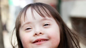 Charakterystycznym objawem zespołu Downa są małe, skośne oczy