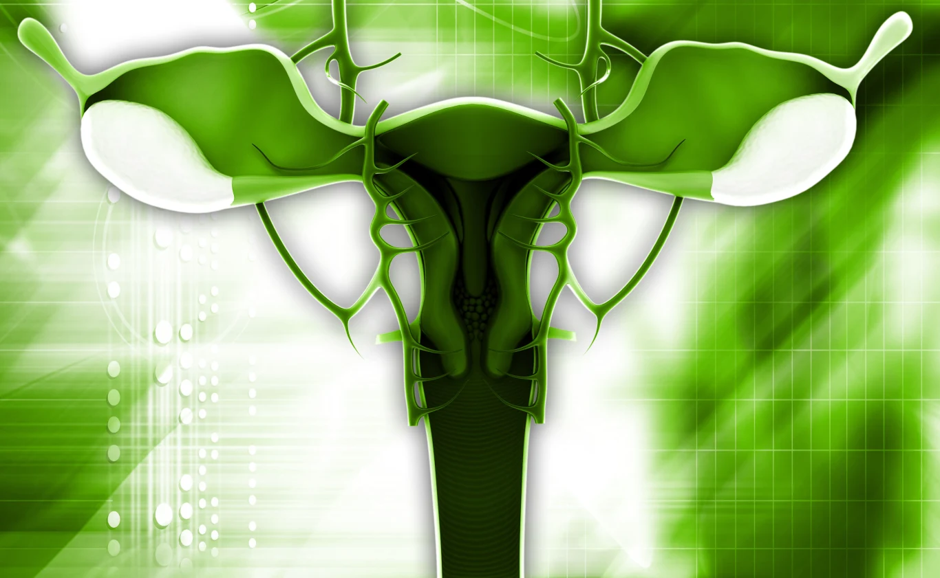 Nieleczona endometrioza moze doprowadzić do bezpłodności Nieleczona endometrioza moze doprowadzić do bezpłodności