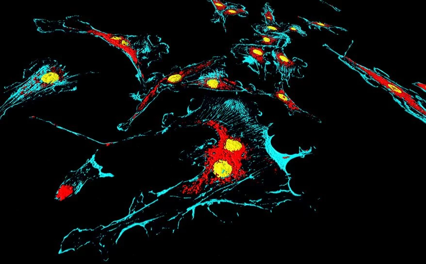 Mitochondria (czerwone) są ważne nie tylko dla zdrowych komórek, ale i nowotworowych