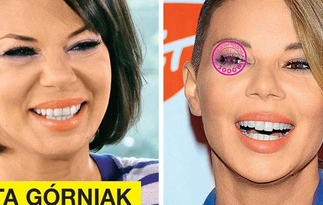 Tygodnik "Na Żywo" twierdzi, że wokalistka powiększyła zęby. Czy faktycznie? Tygodnik "Na Żywo" twierdzi, że wokalistka powiększyła zęby. Czy faktycznie?