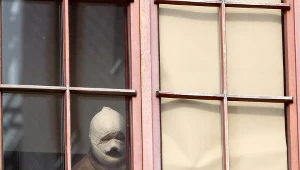 Jeden z pacjentów Centrum Leczenia Oparzeń w Siemianowicach Śląskich