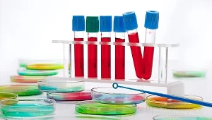 Albuminy są ważnym składnikiem krwi