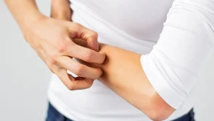 Choroba Duhringa to dokuczliwa choroba skórna