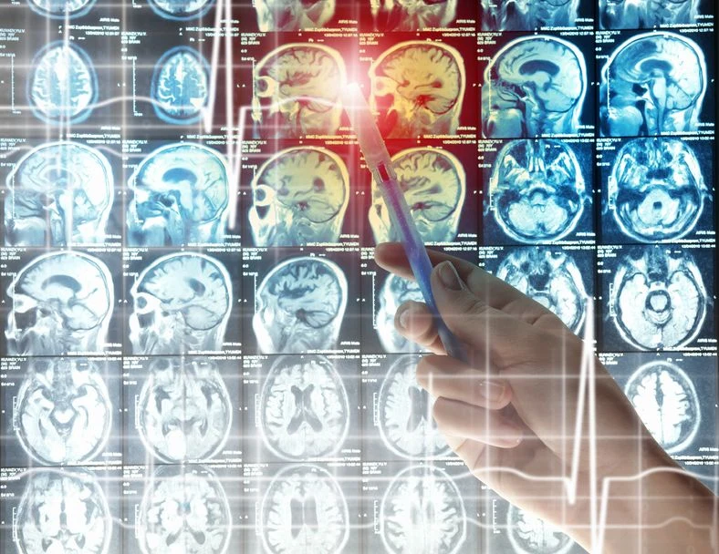 NSDR ma łagodzić stres i poprawiać pamięć NSDR ma łagodzić stres i poprawiać pamięć