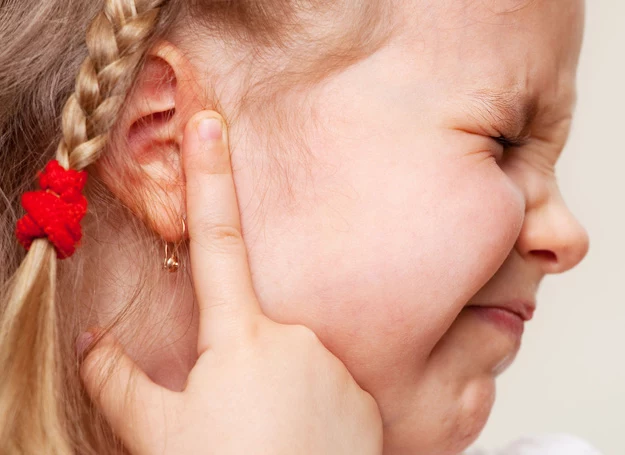 U dzieci alergicznych szczególnie często występuje tzw. wysiękowe zapalenie ucha. U dzieci alergicznych szczególnie często występuje tzw. wysiękowe zapalenie ucha.