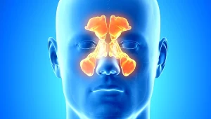 Nieleczone zatoki mogą prowadzić do bardzo groźnych powikłań