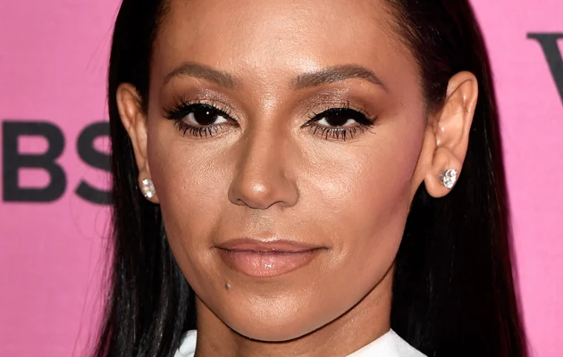 Mel B nie widzi na jedno oko!