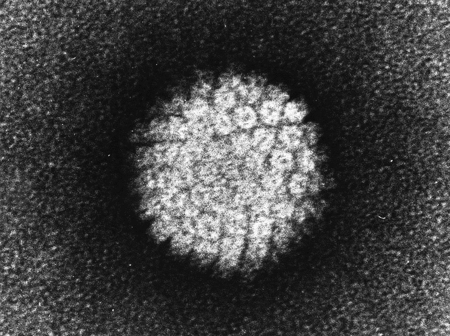 HPV w obrazie mikroskopu elektronowego (Fot. Laboratory of Tumor Virus Biology)