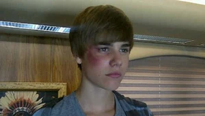 Justin Bieber  i jego imponujący, sztuczny siniak