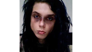 Andy Biersack z Black Veil Brides: "Ból jest nie do zniesienia"