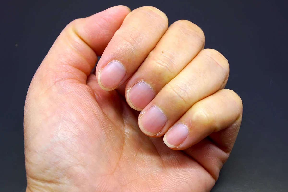 Tak wzmocnisz łamliwe paznokcie. Tak wzmocnisz łamliwe paznokcie.