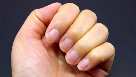 Tak wzmocnisz łamliwe paznokcie.