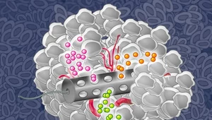 Urządzenie wielkości ziarna ryżu zrewolucjonizuje onkologię?